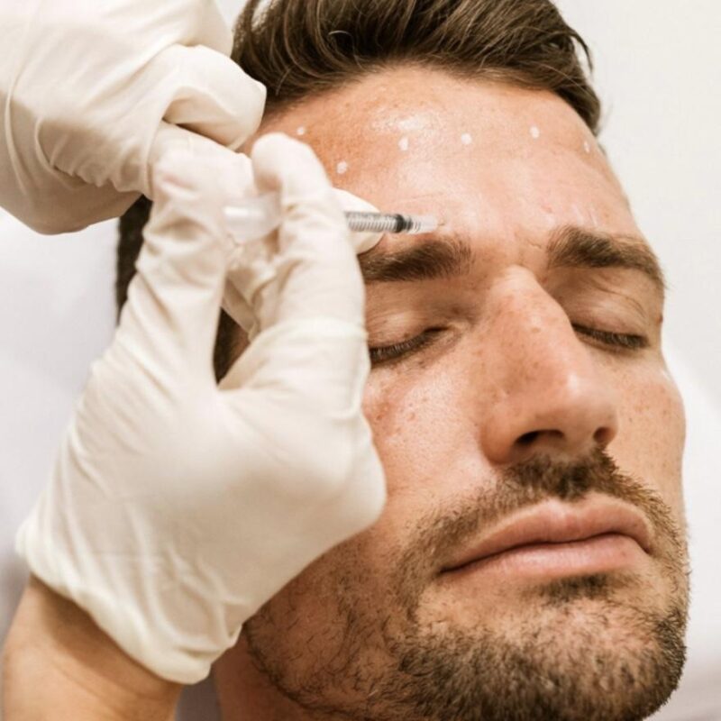 Anti Wrinkle Injections (Male) Treatment