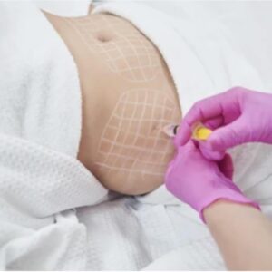 Aqualyx Fat Dissolving Course