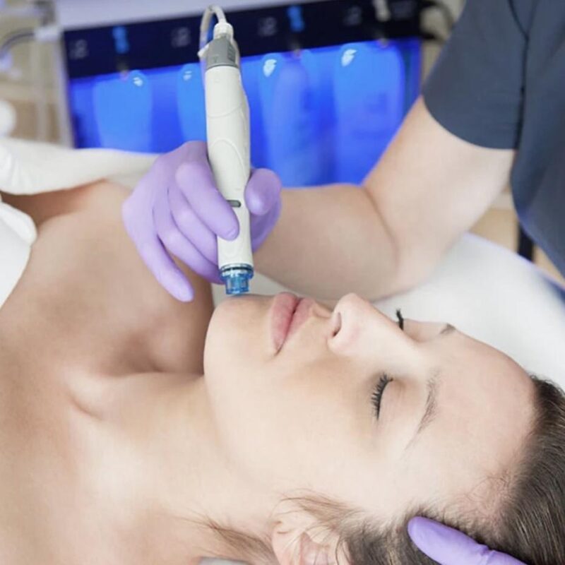 Hydra Facial Treatment