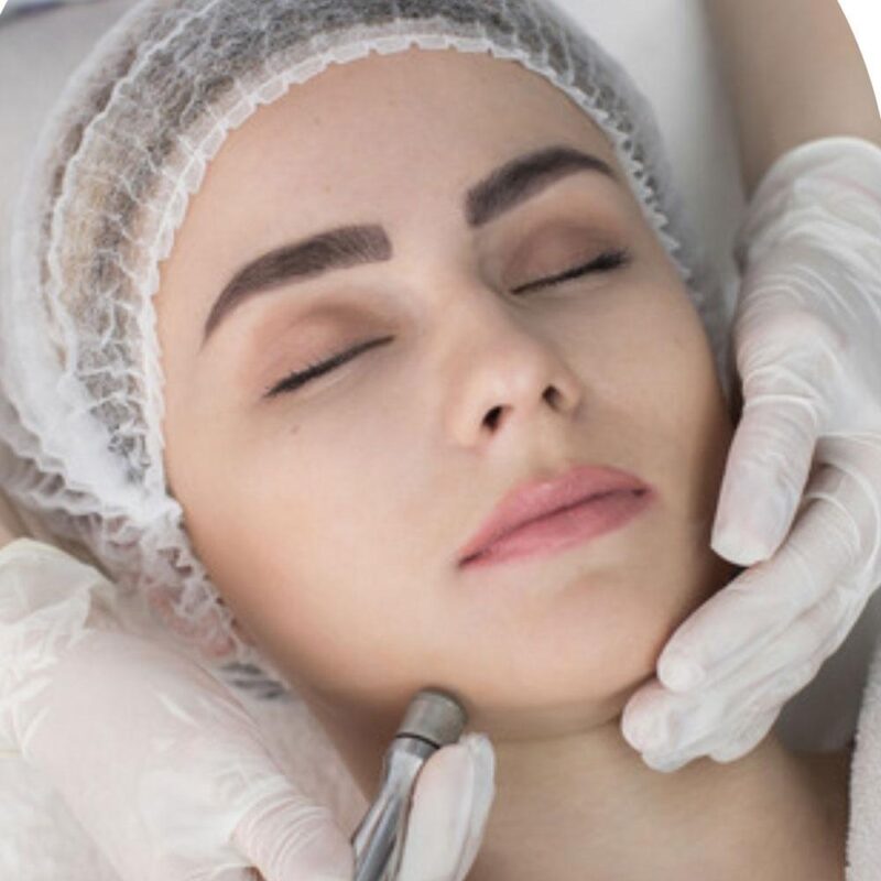 Microdermabrasion