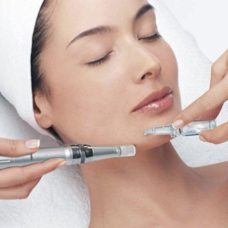 PRP (Platelet Rich Plasma)